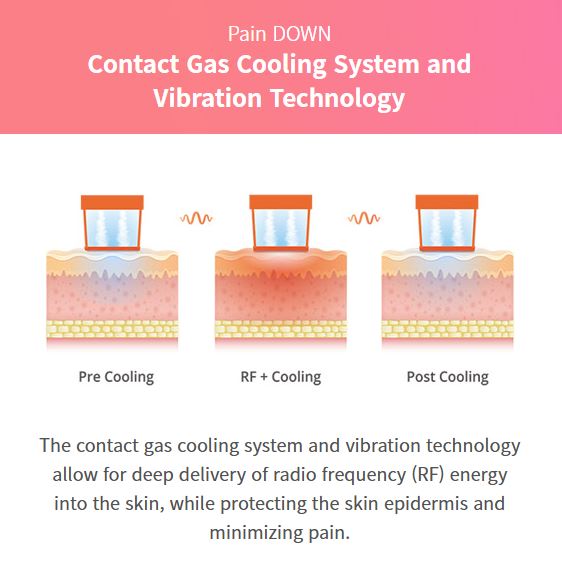 [Radio Frequency] Oligio - Radio Frequency Lifting & Tightening Device