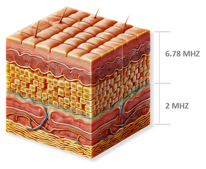 [Radio Frequency] XERF - Dual Frequency Lifting & Tightening