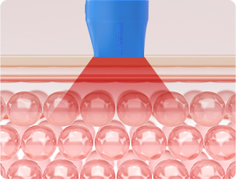 [Radio Frequency] 10Therma (TENTHERMA) - Radio Frequency Lifting & Tightening Device