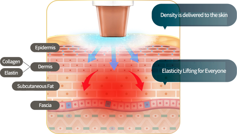 [Radio Frequency] Density - Dual Frequency Lifting & Tightening