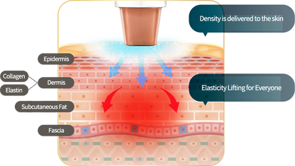 [Radio Frequency] Density - Dual Frequency Lifting & Tightening