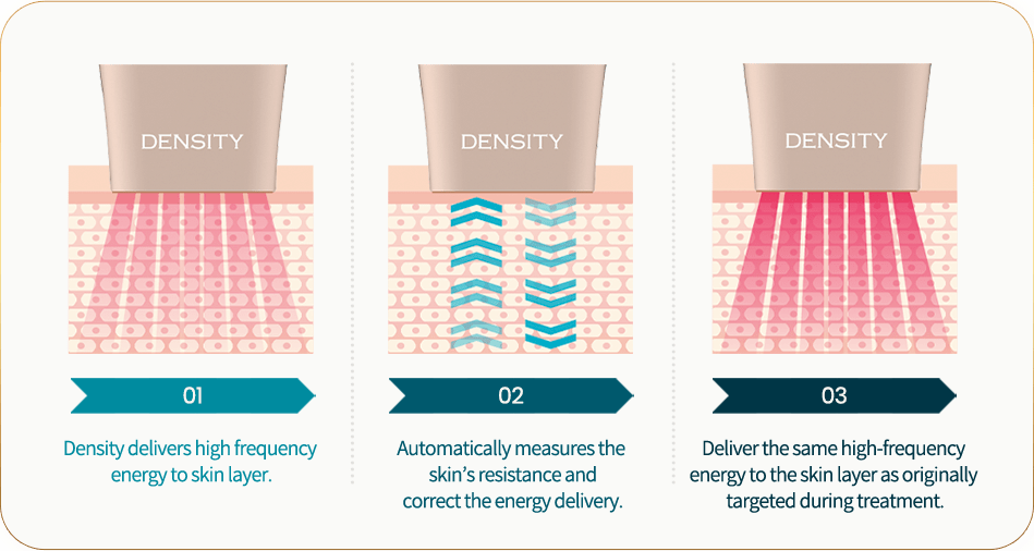 [Radio Frequency] Density - Dual Frequency Lifting & Tightening