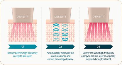 [Radio Frequency] Density - Dual Frequency Lifting & Tightening